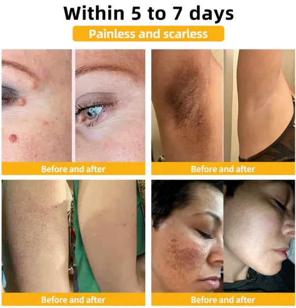 ✨Renueva tu piel de manera natural con 🌿Bee Venom