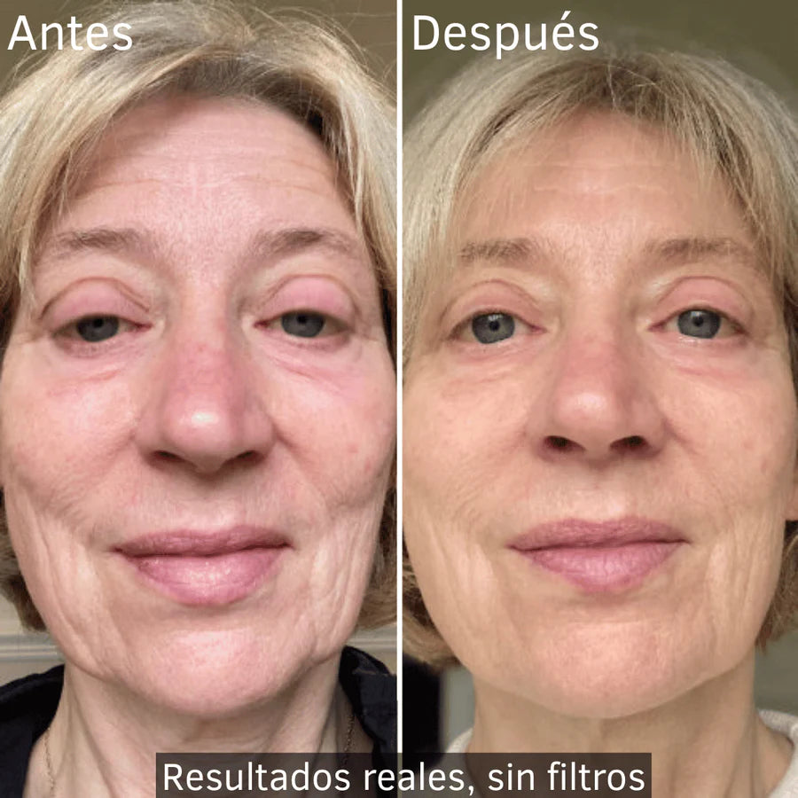 LumiMask — Terapia Lumínica Profesional en Casa